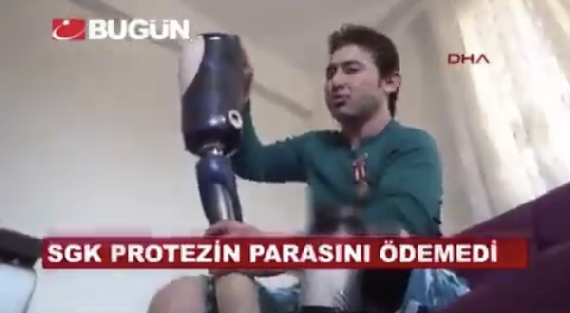 Gazi askerin protez bacağına haciz gelmişti… 